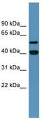 Damage Specific DNA Binding Protein 2 antibody, TA342865, Origene, Western Blot image 