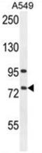 Arachidonate 12-Lipoxygenase, 12R Type antibody, AP50152PU-N, Origene, Western Blot image 