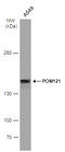 POM121 antibody, GTX102128, GeneTex, Western Blot image 