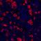 TNF Receptor Superfamily Member 8 antibody, A700-055, Bethyl Labs, Immunohistochemistry paraffin image 