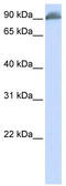 Erythrocyte Membrane Protein Band 4.1 antibody, TA329524, Origene, Western Blot image 