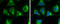 3-ketoacyl-CoA thiolase, mitochondrial antibody, GTX115417, GeneTex, Immunocytochemistry image 