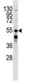 ADRB2 antibody, AP13972PU-N, Origene, Western Blot image 