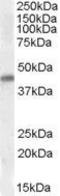 NK2 Homeobox 5 antibody, GTX88402, GeneTex, Western Blot image 