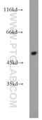 Alpha-1-antiproteinase antibody, 16382-1-AP, Proteintech Group, Western Blot image 