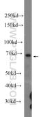 Baculoviral IAP Repeat Containing 3 antibody, 24304-1-AP, Proteintech Group, Western Blot image 
