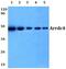 Arrestin Domain Containing 4 antibody, PA5-36518, Invitrogen Antibodies, Western Blot image 
