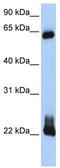 Rho-related GTP-binding protein RhoD antibody, TA344100, Origene, Western Blot image 