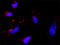 ShcA antibody, LS-B4416, Lifespan Biosciences, Proximity Ligation Assay image 