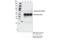 Bruton Tyrosine Kinase antibody, 87457S, Cell Signaling Technology, Immunoprecipitation image 