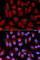 Transporter 2, ATP Binding Cassette Subfamily B Member antibody, A1610, ABclonal Technology, Immunofluorescence image 