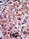 Phosphofructokinase, Liver Type antibody, 63-417, ProSci, Immunohistochemistry paraffin image 