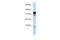 Peroxisomal Testis Enriched Protein 1 antibody, 27-048, ProSci, Western Blot image 