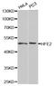 Hemojuvelin antibody, A32104, Boster Biological Technology, Western Blot image 