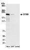 Synemin antibody, A305-413A, Bethyl Labs, Western Blot image 