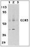 C-C Motif Chemokine Receptor 3 antibody, LS-B3185, Lifespan Biosciences, Western Blot image 