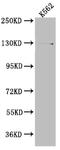 Ubiquitin Specific Peptidase 7 antibody, CSB-RA192026A0HU, Cusabio, Western Blot image 