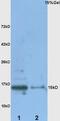 Metallothionein-1 antibody, A30377, Boster Biological Technology, Western Blot image 