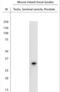 Steroid 5 Alpha-Reductase 2 antibody, NBP1-46510, Novus Biologicals, Western Blot image 