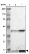 Ribosomal Protein L23 antibody, NBP1-87847, Novus Biologicals, Western Blot image 
