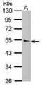 RAR Related Orphan Receptor B antibody, PA5-30152, Invitrogen Antibodies, Western Blot image 