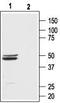 Bombesin Receptor Subtype 3 antibody, TA328616, Origene, Western Blot image 