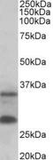U6 snRNA phosphodiesterase antibody, TA311525, Origene, Western Blot image 