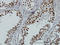 RBMX Like 2 antibody, LS-C133727, Lifespan Biosciences, Immunohistochemistry paraffin image 