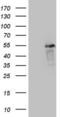 Leucine Rich Repeat Containing 6 antibody, LS-C339787, Lifespan Biosciences, Western Blot image 