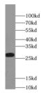 Nucleoredoxin Like 1 antibody, FNab09132, FineTest, Western Blot image 