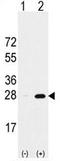 Proteasome Subunit Alpha 5 antibody, AP11429PU-N, Origene, Western Blot image 