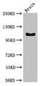 Desmoglein 3 antibody, LS-C677733, Lifespan Biosciences, Western Blot image 