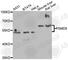 Proteasome 26S Subunit, Non-ATPase 5 antibody, A6954, ABclonal Technology, Western Blot image 