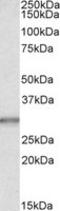 CA1 antibody, TA305634, Origene, Western Blot image 