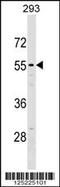 5'-Nucleotidase Domain Containing 2 antibody, 59-681, ProSci, Western Blot image 