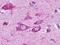 Endothelin B receptor-like protein 2 antibody, LS-A406, Lifespan Biosciences, Immunohistochemistry paraffin image 