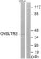 Cysteinyl Leukotriene Receptor 2 antibody, LS-C120570, Lifespan Biosciences, Western Blot image 
