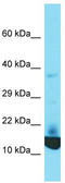 Keratinocyte-associated protein 2 antibody, TA337405, Origene, Western Blot image 