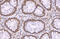 p21 antibody, GTX112898, GeneTex, Immunohistochemistry paraffin image 