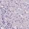 ATPase H+ Transporting V1 Subunit D antibody, NBP1-88895, Novus Biologicals, Immunohistochemistry paraffin image 