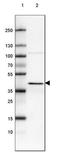 3-ketoacyl-CoA thiolase, peroxisomal antibody, NBP2-42381, Novus Biologicals, Western Blot image 