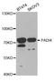 Peptidyl Arginine Deiminase 4 antibody, TA332458, Origene, Western Blot image 