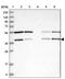 LanC Like 1 antibody, PA5-57107, Invitrogen Antibodies, Western Blot image 