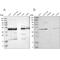 Cytochrome b-c1 complex subunit 2, mitochondrial antibody, PA5-53939, Invitrogen Antibodies, Western Blot image 