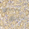 Death-associated protein kinase 1 antibody, A5741, ABclonal Technology, Immunohistochemistry paraffin image 