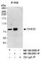 Putative ATP-dependent RNA helicase DHX33 antibody, NB100-2580, Novus Biologicals, Immunoprecipitation image 