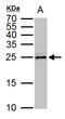 Tubulin Polymerization Promoting Protein antibody, GTX119520, GeneTex, Western Blot image 