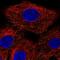 Ankyrin Repeat And FYVE Domain Containing 1 antibody, NBP2-57520, Novus Biologicals, Immunofluorescence image 