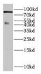 DLEC1 Cilia And Flagella Associated Protein antibody, FNab02407, FineTest, Western Blot image 