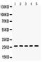 Hydroxysteroid 17-Beta Dehydrogenase 10 antibody, PA5-79401, Invitrogen Antibodies, Western Blot image 